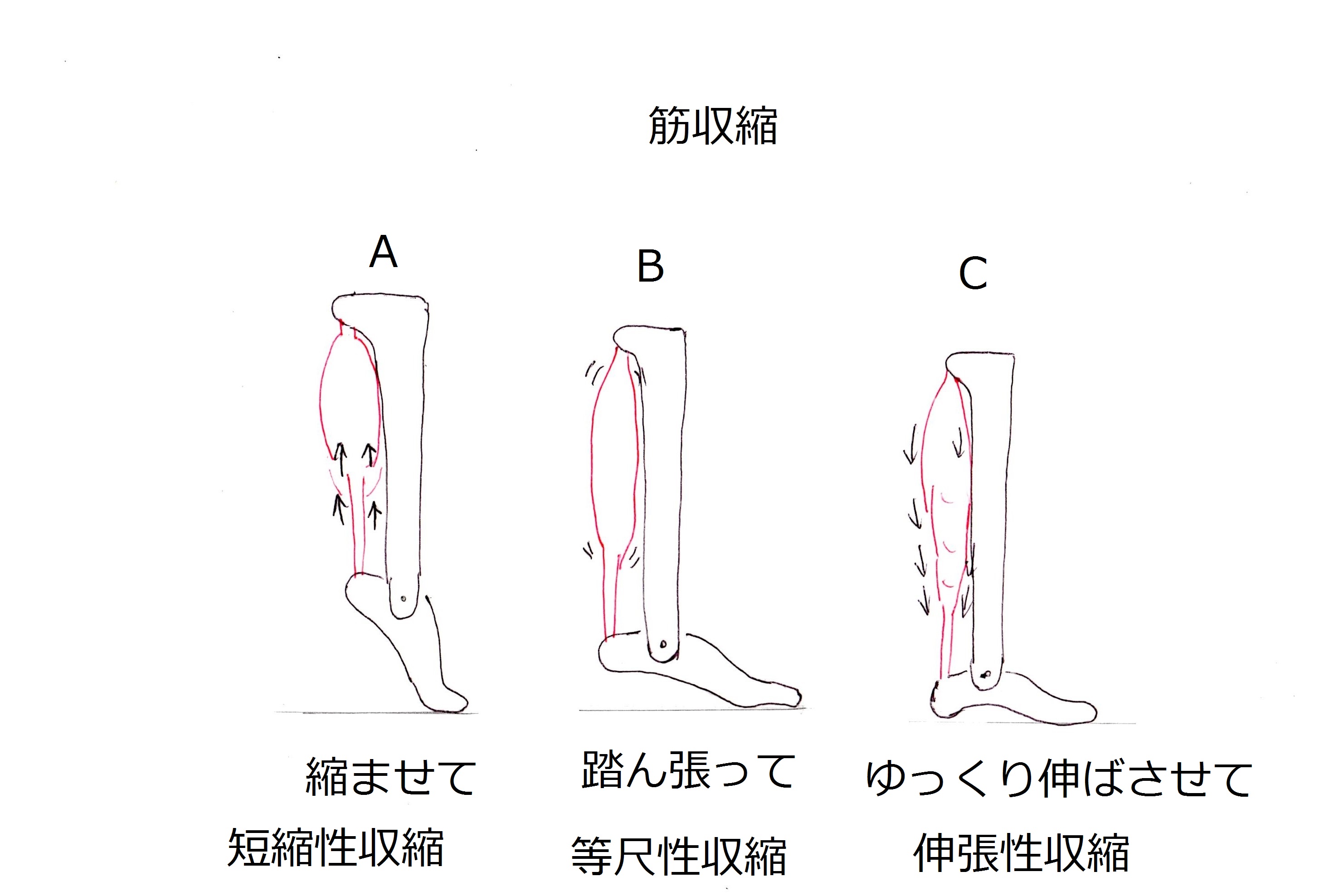 膝痛予防改善 登山 トレッキング の下り方